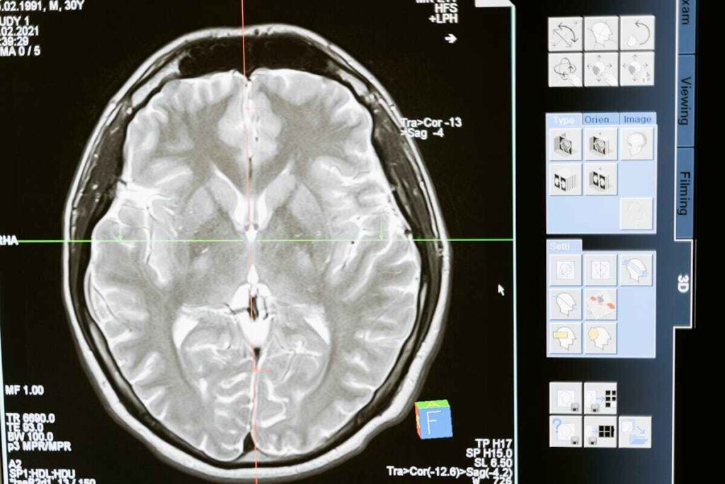 Cervello rettiliano: l'immagine di un'ecografia all'encefalo