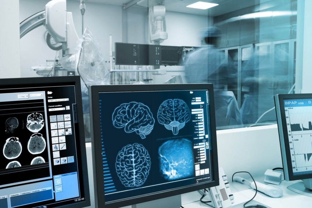 cosa succese al cervello in coma