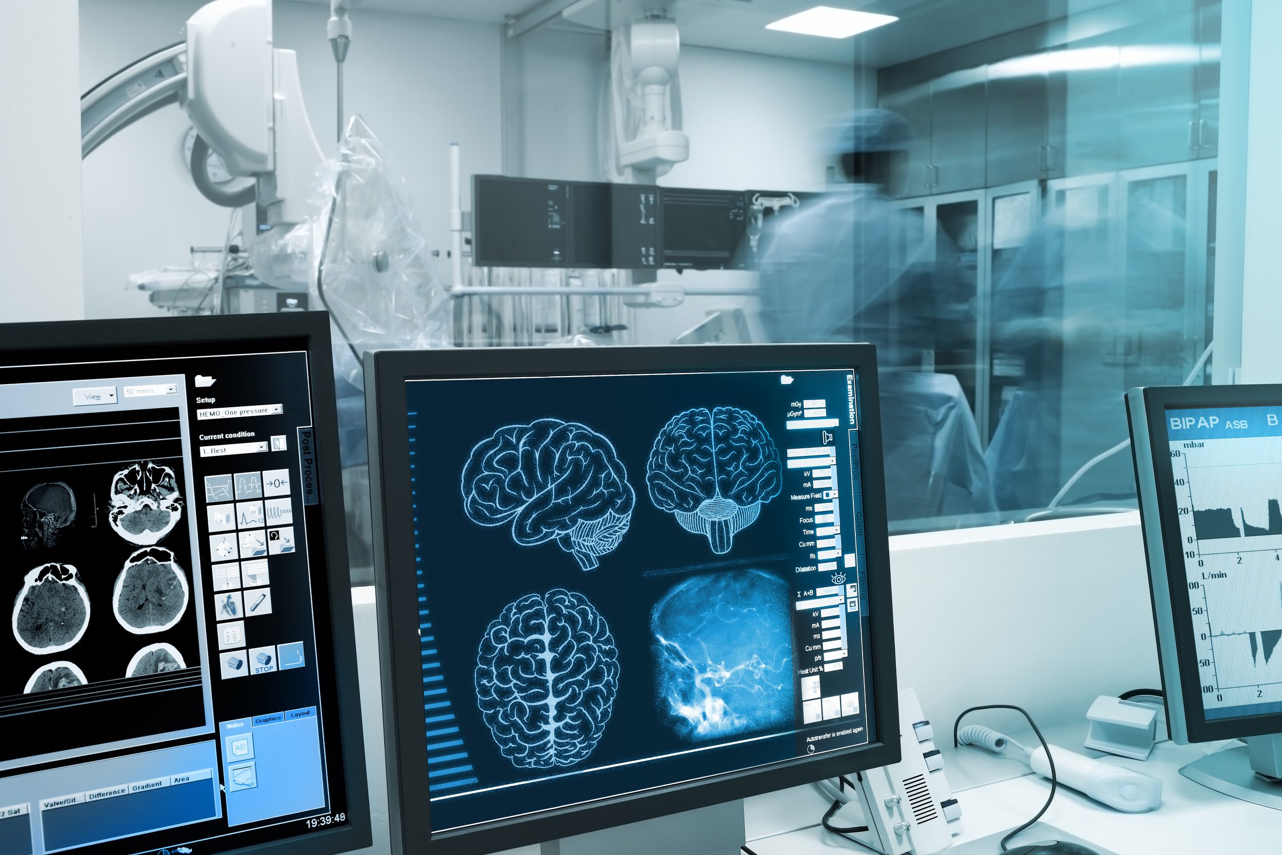 cosa succese al cervello in coma